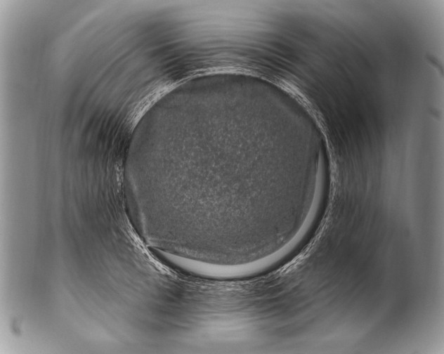 X0000100390993200806201710