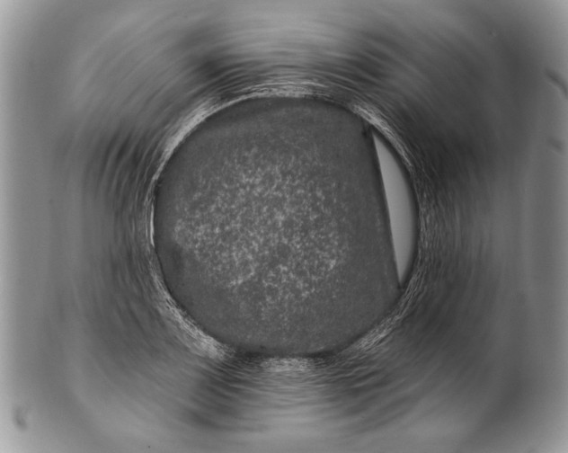 X0000100391083200806201708