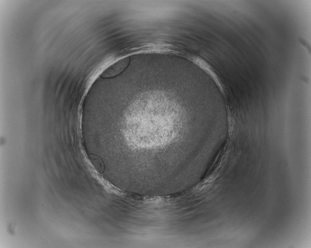 X0000100391099200806201708