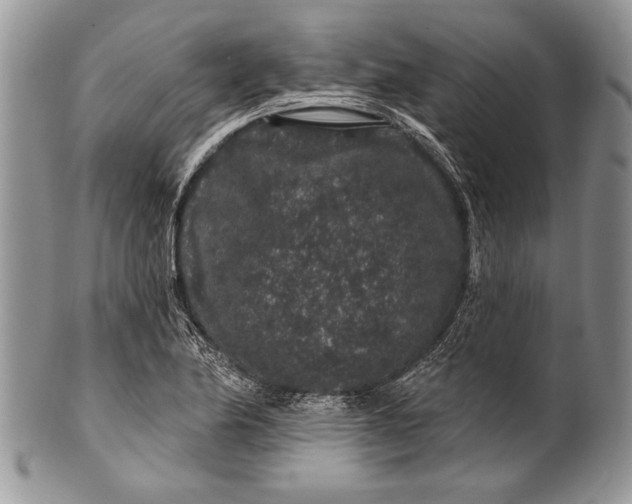 X0000100391174200806201707