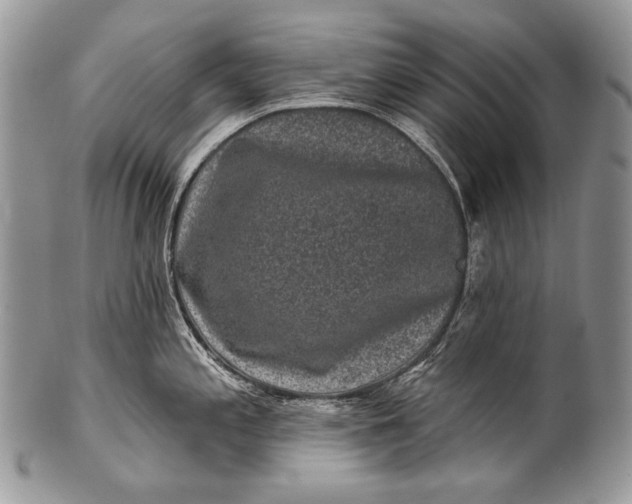 X0000100391197200806201706