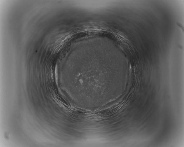 X0000100391252200806201705