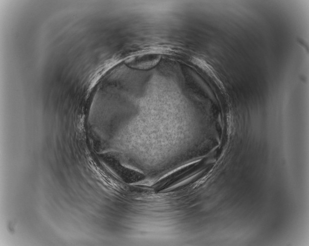 X0000100391260200806201705