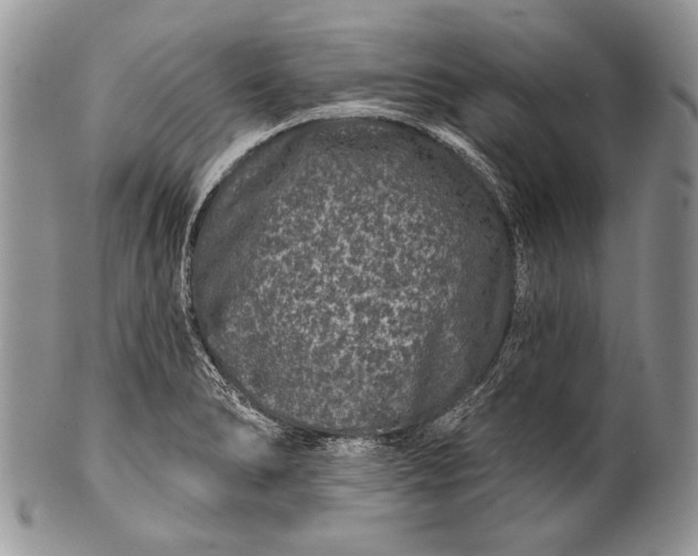 X0000100391278200806201705