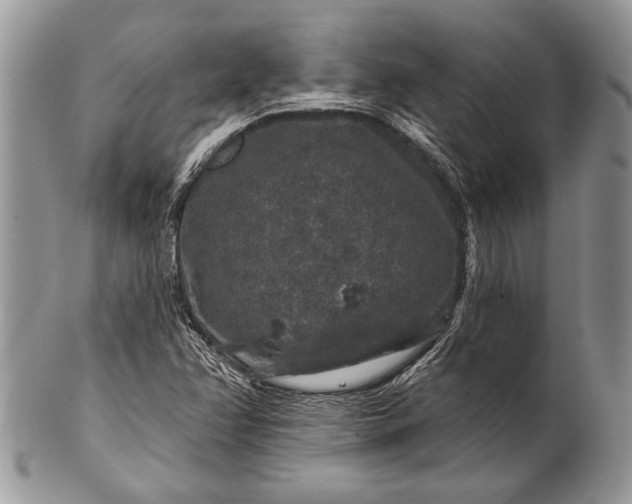 X0000100391358200806201704