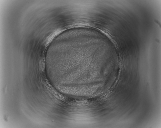 X0000100391363200806201704