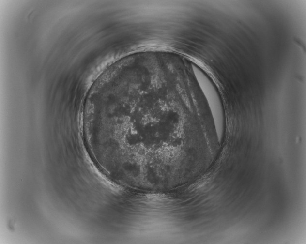 X0000100391383200806201703