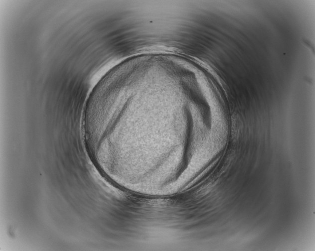 X0000100391387200806201703