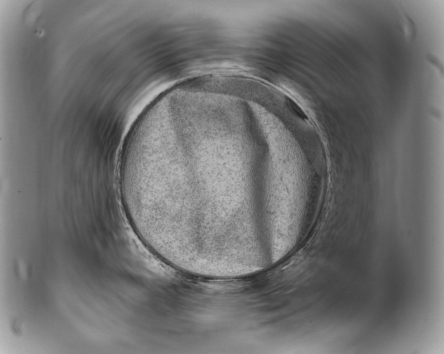 X0000100391392200806201703