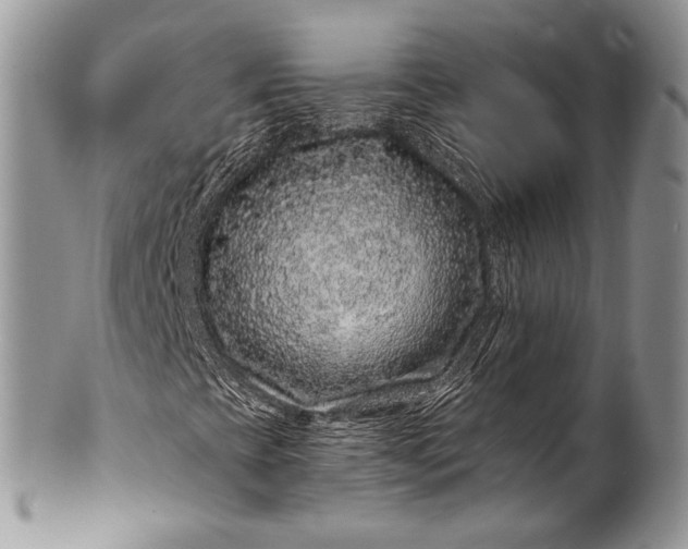 X0000100391393200806201703