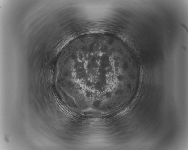 X0000100391401200806201703