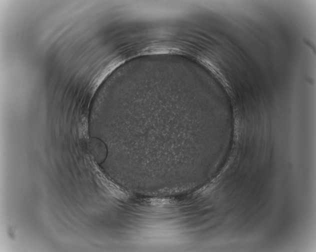 X0000100391465200806201702