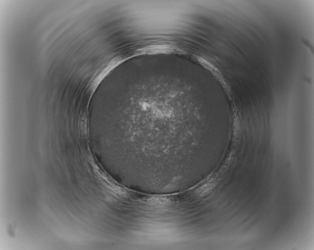 X0000100391473200806201702