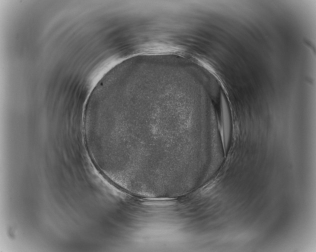 X0000100391487200806201702