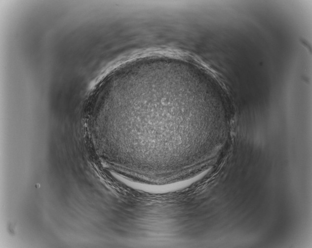 X0000100391496200806201701