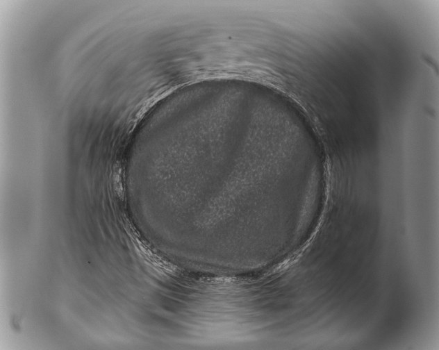 X0000100391497200806201701