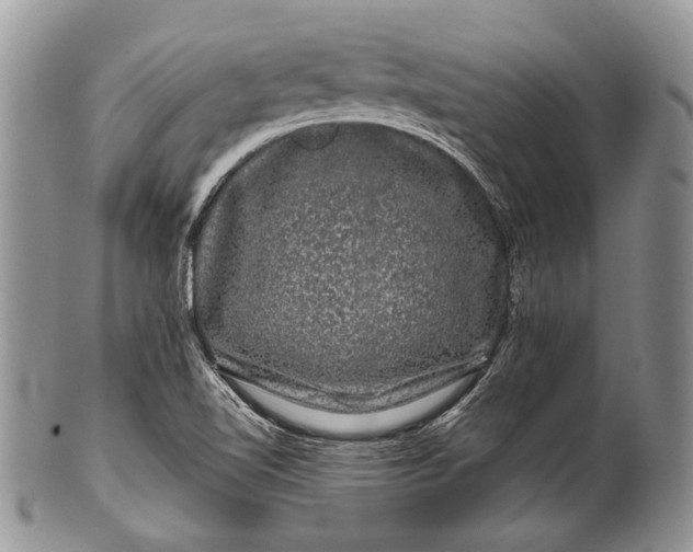 X0000100391510200806201702