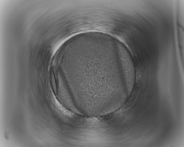 X0000100391524200806201702