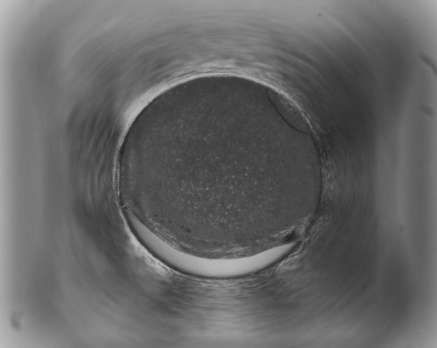 X0000100391527200806201702