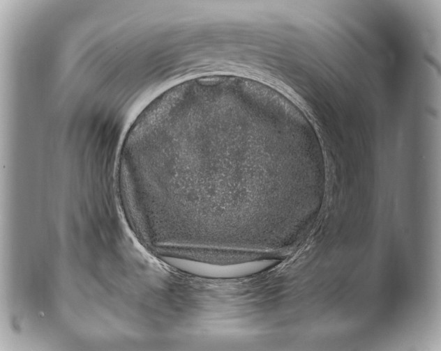 X0000100391536200806201702