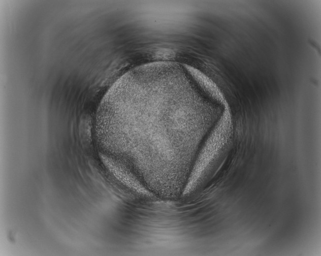 X0000100390363200806271402