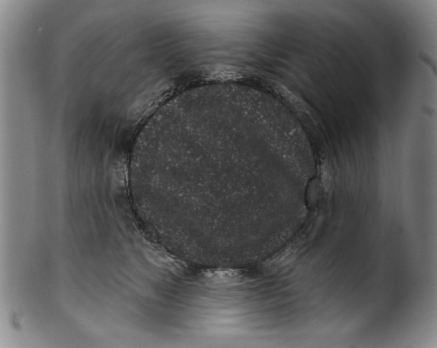 X0000100390517200806271400