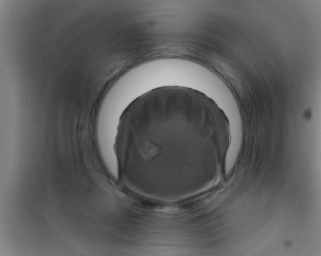 X0000100390362200807031955