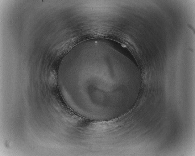 X0000100400029200806131023