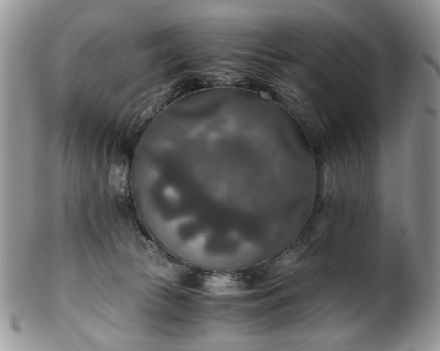 X0000100400177200806131021