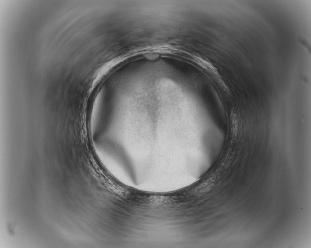 X0000100401176200806201729
