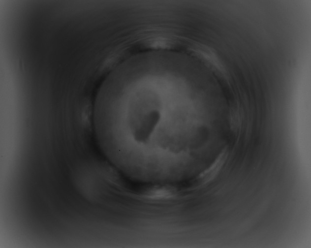 X0000100420175200806061411