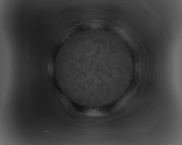 X0000100420177200806061411