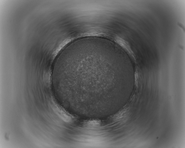 X0000100420156200806131106