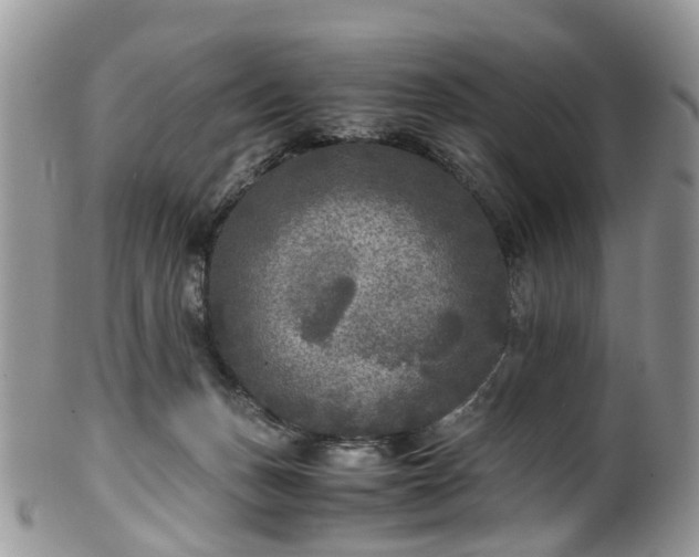 X0000100420175200806131107