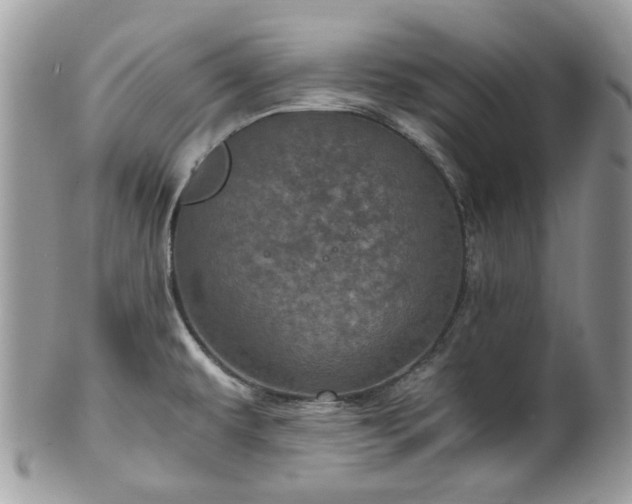 X0000100421479200806131047