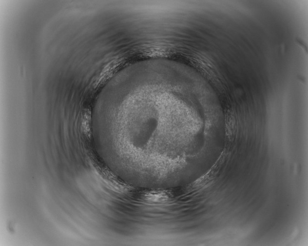 X0000100420175200806201831