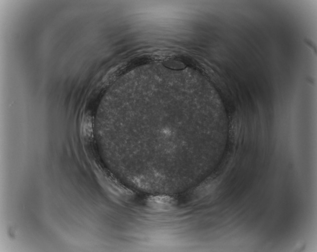 X0000100420137200806271516