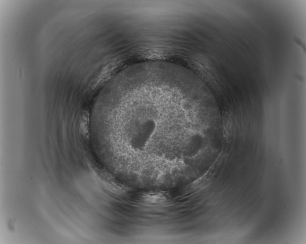 X0000100420175200806271515