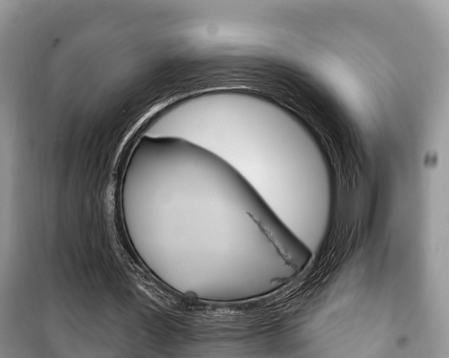 X0000100470387200806130759