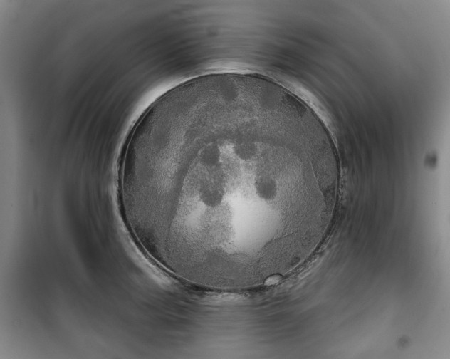 X0000100471187200806131120