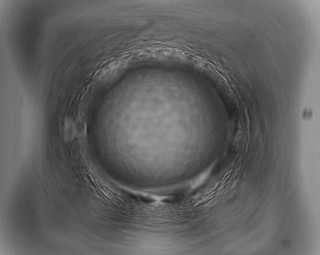 X0000100471489200806131115