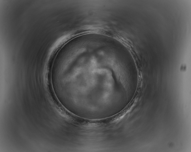 X0000100470149200806201614