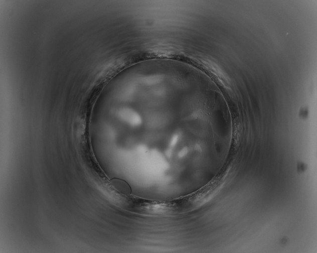 X0000100470365200806201612