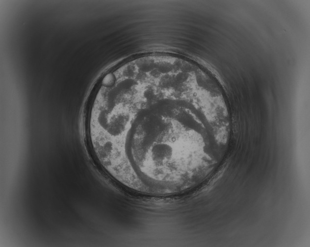 X0000100470987200807111037