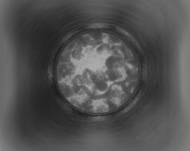 X0000100471017200807111036