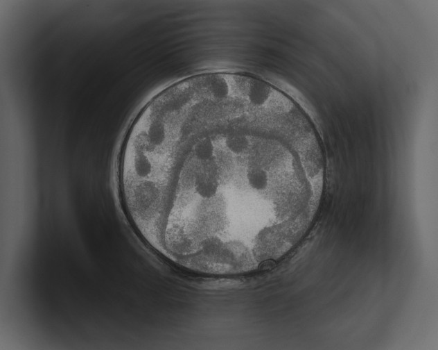 X0000100471187200807111035