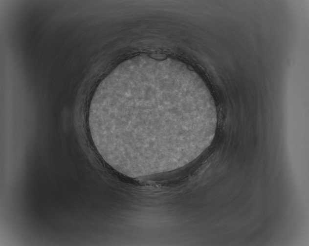 X0000100471489200807111030