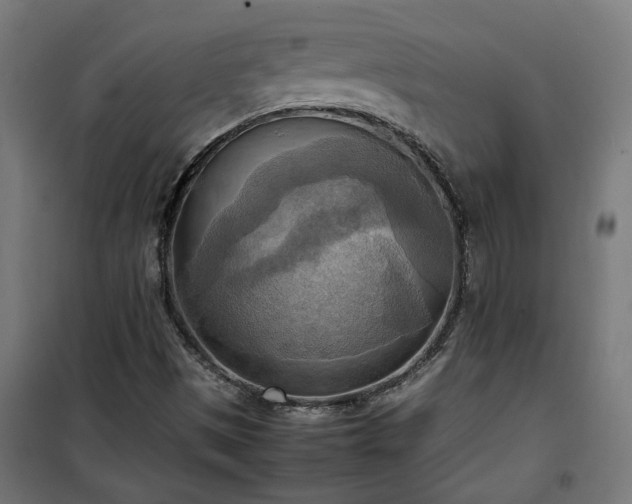 X0000100481497200806201617