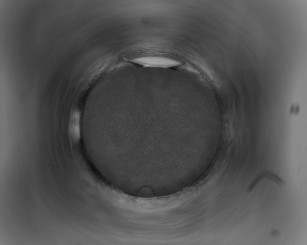 X0000100490022200806201703