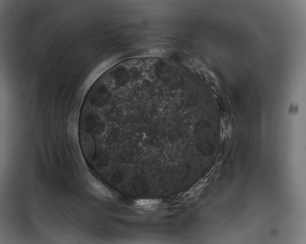 X0000100490051200806201702